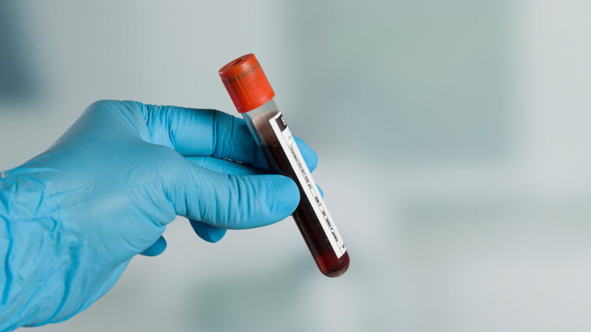 Gloved hand holding a labelled blood sample tube in a clinical setting.